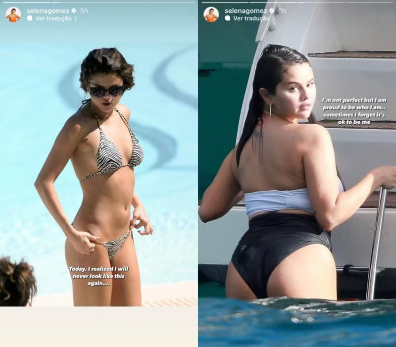 Selena Gomez compara antes e depois de seu corpo