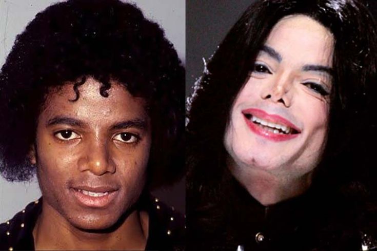 Guarda-costas conta os motivos de Michael Jackson fazer várias plásticas no nariz